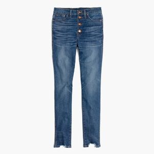 Madewell 10" skinny jeans: chewed-hem edition
